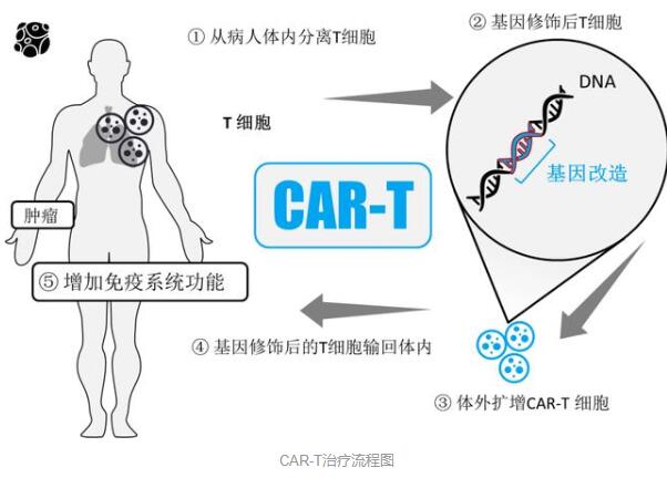 喜讯！我国CAR-T疗法治疗复发难治多发性骨髓瘤获突破