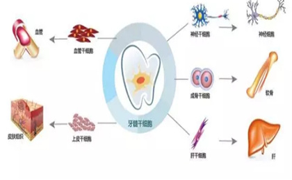 乳牙干细胞应用范围大，治疗优势无可替代