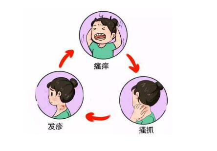 干细胞成为特应性皮炎的新治疗方法